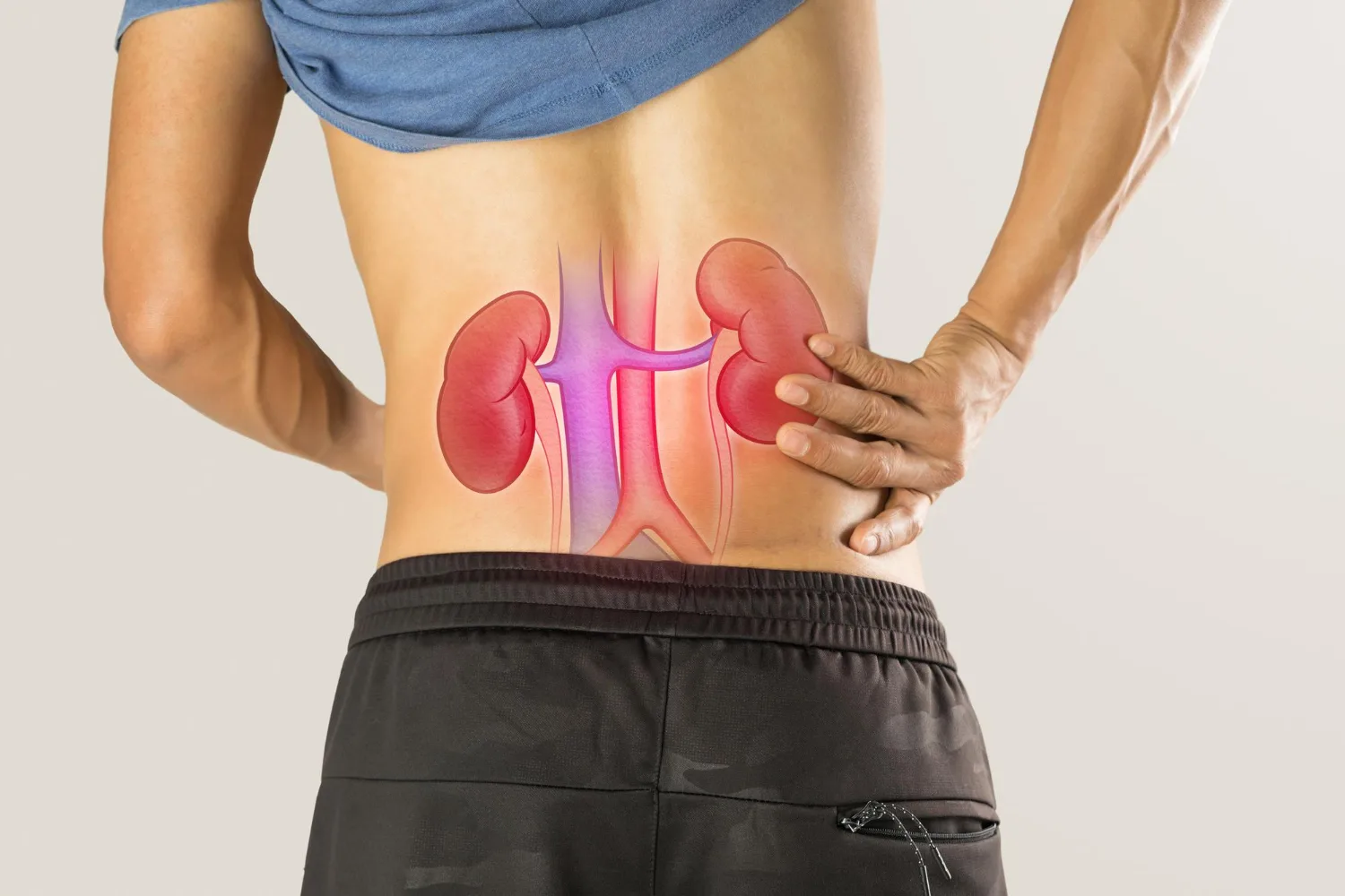 Enfermedad renal avanzada y preparación para diálisis